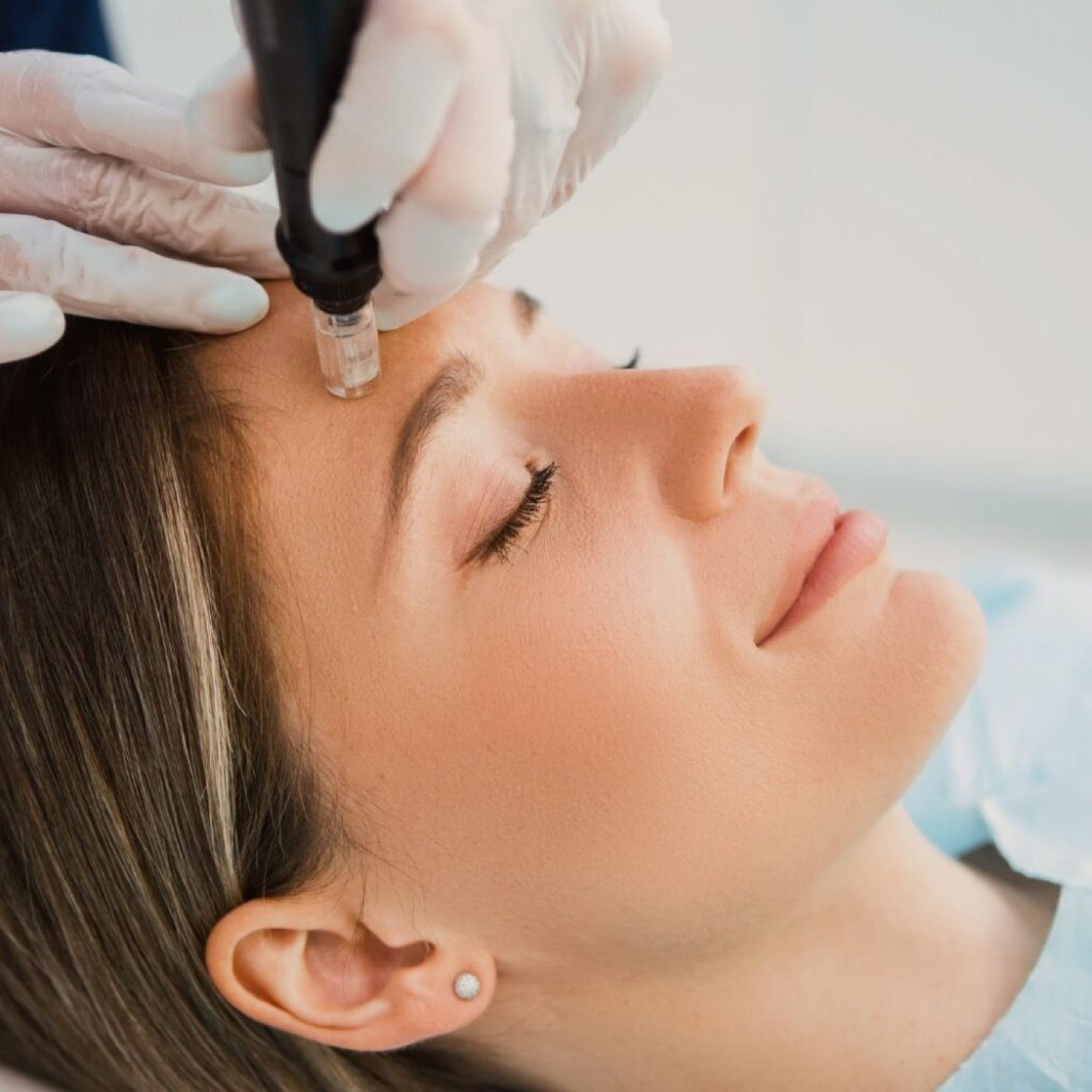 Medical Beauty — Needling und apparative Hautverbesserung